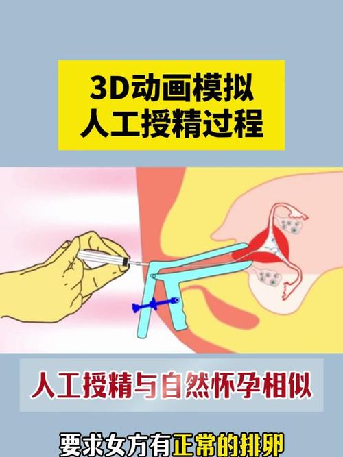 人工授精视频2026