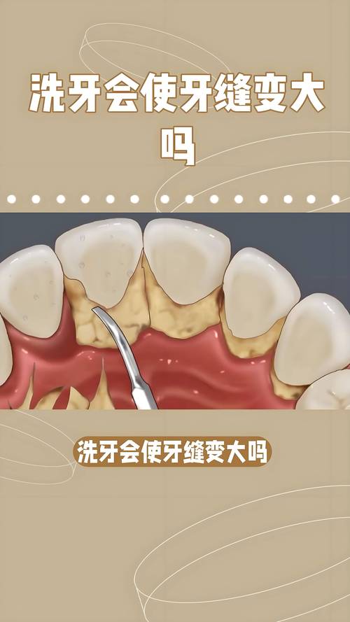 洗牙全过程视频2026