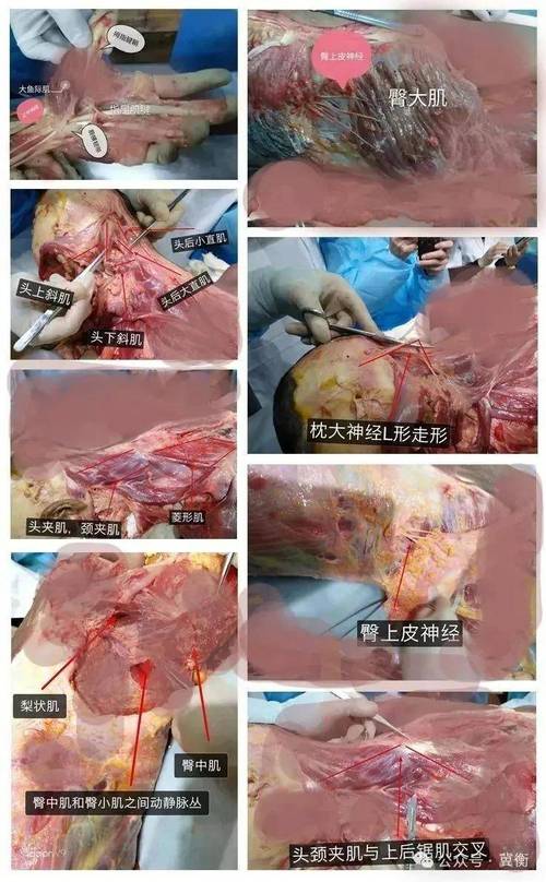 解刨视频2026