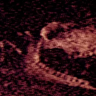 铁肺游戏手机版